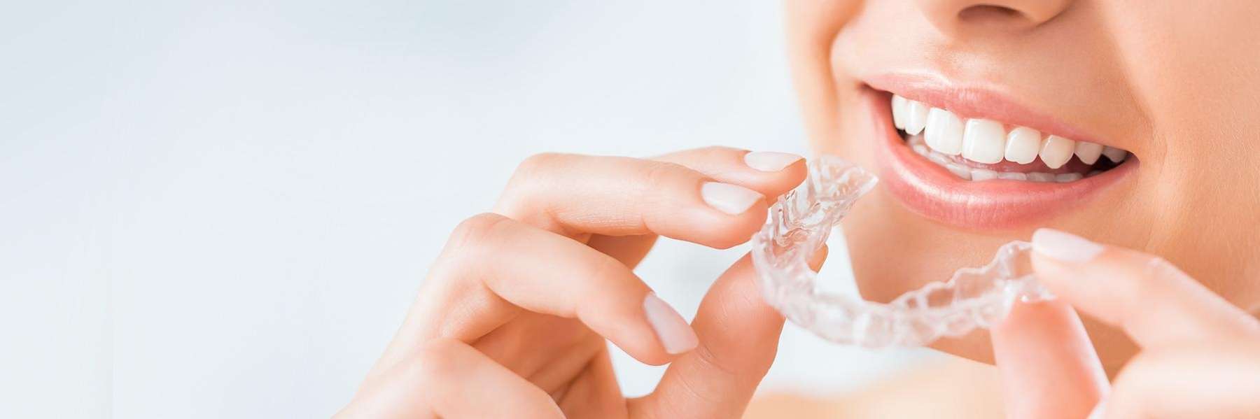 SureSmile® Clear Aligners | Dentist